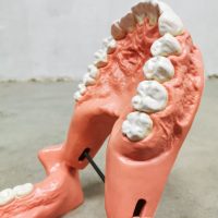 Gebit vintage schaalmodel anatomisch teeth scale model body parts